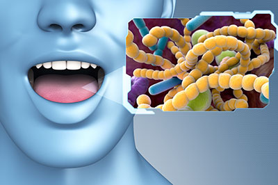 The image features a person with an open mouth holding a sign displaying a microscopic view of bacteria, emphasizing the importance of dental hygiene.