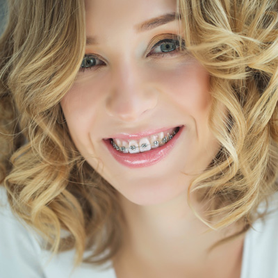 A woman with braces smiles at the camera.