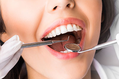A woman with a wide smile is having her teeth cleaned by a dental hygienist who is holding a toothbrush and using dental instruments, both are dressed professionally.