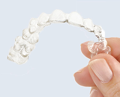 Invisalign - An Invisible Solution To Straighten Teeth - Diamond Head  Dental Care Honolulu Hawaii